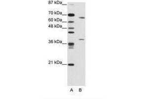 Image no. 2 for anti-Grainyhead-Like 3 (GRHL3) (AA 529-578) antibody (ABIN203223) (GRHL3 抗体  (AA 529-578))