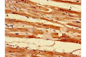 Immunohistochemistry of paraffin-embedded human heart tissue using ABIN7142451 at dilution of 1:100 (MRPL55 抗体  (AA 34-128))