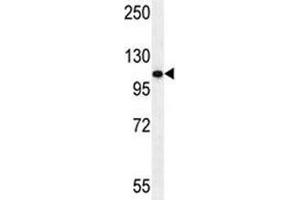 Androgen Receptor antibody western blot analysis in HeLa lysate (Androgen Receptor 抗体  (AA 365-392))