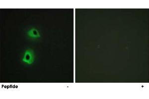 Immunofluorescence analysis of HeLa cells, using TRAF3IP3 polyclonal antibody . (TRAF3IP3 抗体)
