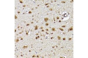 Immunohistochemistry of paraffin-embedded rat brain using UBQLN4 Rabbit pAb (ABIN7271124) at dilution of 1:150 (40x lens). (UBQLN4 抗体  (AA 300-390))