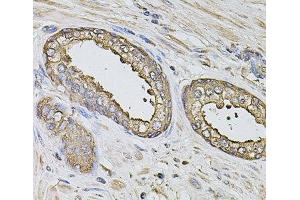 Immunohistochemistry of paraffin-embedded Human prostate using S100A12 Polyclonal Antibody at dilution of 1:100 (40x lens). (S100A12 抗体)