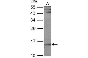 WB Image Sample (30 ug of whole cell lysate) A: NIH-3T3 12% SDS PAGE antibody diluted at 1:1000 (UBE2B 抗体)