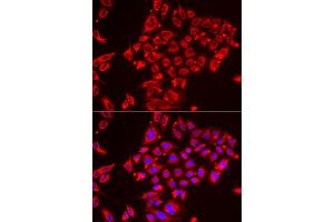 Immunofluorescence analysis of HeLa cell using ST3GAL3 antibody. (ST3GAL3 抗体)