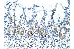 ADAT1 antibody was used for immunohistochemistry at a concentration of 4-8 ug/ml to stain Epithelial cells of fundic gland (arrows) in Human Stomach. (ADAT1 抗体  (C-Term))