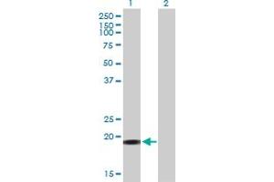 Western Blot analysis of YSK4 expression in transfected 293T cell line by YSK4 MaxPab polyclonal antibody. (MAP3K19 抗体  (AA 1-168))