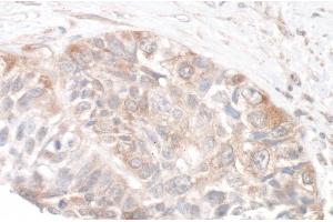 Immunohistochemistry (IHC) image for anti-RPTOR Independent Companion of mTOR, Complex 2 (RICTOR) (C-Term) antibody (ABIN7454633) (RICTOR 抗体  (C-Term))