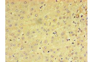 Immunohistochemistry of paraffin-embedded human liver tissue using ABIN7159237 at dilution of 1:100 (PRAME 抗体  (AA 1-509))