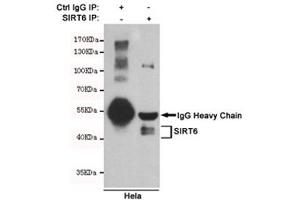 Immunoprecipitation of SIRT6 from HeLa cell lysate using SIRT6 antibody. (SIRT6 抗体)