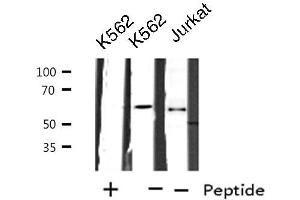 Western blot analysis of extracts from K562/Jurkat cells, using CYP2A7 antibody.