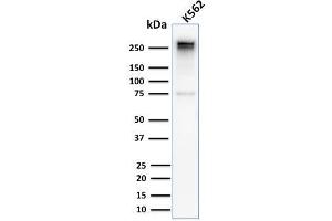 Western Blot Analysis of Human K562 cell lysate using Spectrin alpha 1 Rabbit Recombinant Monoclonal Antibody (SPTA1/2939R). (Recombinant SPTA1 抗体  (AA 356-475))