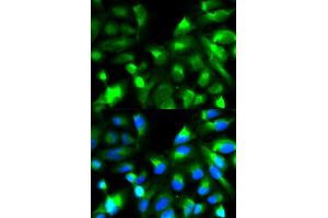 Immunofluorescence analysis of HeLa cells using SNAP25 antibody (ABIN5970374). (SNAP25 抗体)
