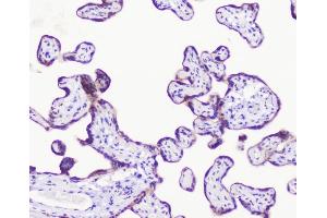 IHC analysis of LATS1 1using anti-LATS1 antibody (ABIN6719580).