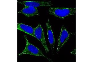 Fluorescent image of SH-SY5Y cells stained with CHRM2 Antibody (ABIN6242476 and ABIN6577085). (Muscarinic Acetylcholine Receptor M2 抗体)