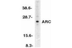 Western blot analysis of ARC in HeLa whole cell lysates with AP30077PU-N ARC antibody at 1/500 dilution. (NOL3 抗体  (N-Term))