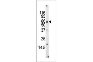 The anti-MLLT3 Pab (ABIN390129 and ABIN2840634) is used in Western blot to detect MLLT3 in mouse cerebellum tissue lysate (AF9 抗体  (AA 407-438))