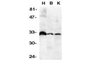 Western Blotting (WB) image for anti-Tumor Necrosis Factor Receptor Superfamily, Member 6b, Decoy (TNFRSF6B) (N-Term) antibody (ABIN499726)
