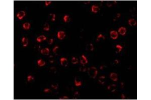 Immunofluorescence of PUMA in K562 cells with this product at 2 µg/ml. (PUMA 抗体  (C-Term))