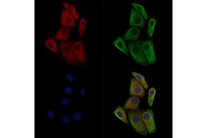 Phospho-TGFBR2 (Ser553) Antibody staining Hela cells(heat shock treatment) by IF/ICC.
