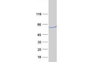 Western Blotting (WB) image for ATPase, H+ Transporting, Lysosomal 56/58kDa, V1 Subunit B2 (ATP6V1B2) protein (Myc-DYKDDDDK Tag) (ABIN2715056)