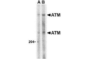 Western blot analysis of ATM in Daudi whole cell lysate with this product atM antibody at (A) 1 and (B) 2 μg/ml. (ATM 抗体  (C-Term))