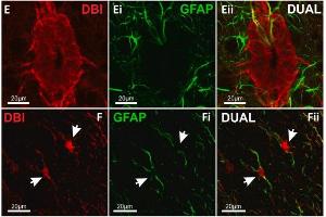 Confocal images showing labelling for DBI in ECL and GFAP+ glial fibers within lamina X of mouse spinal cord. (GFAP 抗体  (AA 411-422))