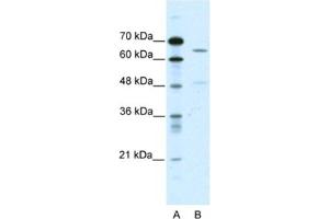 Western Blotting (WB) image for anti-Amiloride-Sensitive Cation Channel 1, Neuronal (ACCN1) antibody (ABIN2461090) (ACCN1 抗体)