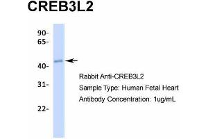 Western Blotting (WB) image for anti-CAMP Responsive Element Binding Protein 3-Like 2 (CREB3L2) (N-Term) antibody (ABIN2775946)