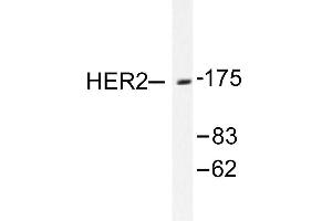 Image no. 1 for anti-Receptor tyrosine-protein kinase erbB-2 (ErbB2/Her2) antibody (ABIN265465) (ErbB2/Her2 抗体)