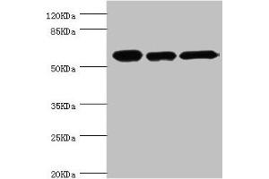 Western blot All lanes: CCT2 antibody at 5. (CCT2 抗体  (AA 206-535))