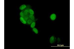 Immunofluorescence of monoclonal antibody to PGR on MCF-7 cell. (Progesterone Receptor 抗体  (AA 1-110))