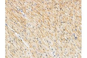 ABIN6256381 and ABIN6267092 at 1/100 staining Rat heart tissue by IHC-P. (TBC1D4 抗体  (pSer588))