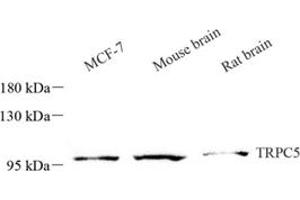 Western Blotting (WB) image for anti-Transient Receptor Potential Cation Channel, Subfamily C, Member 5 (TRPC5) antibody (ABIN7075974)
