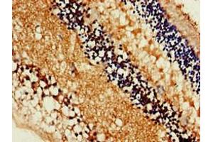 Immunohistochemistry of paraffin-embedded human eye tissue using ABIN7160169 at dilution of 1:100 (MCT3 抗体  (AA 432-504))