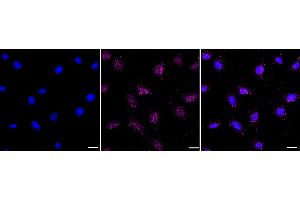 Immunocytochemical staining of HepG2 cells with FOXO1A antibody (ABIN7798644), 1:1,000). (Recombinant FOXO1 抗体)