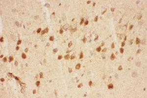 Anti-BDNF Picoband antibody,  IHC(P): Mouse Brain Tissue (BDNF 抗体  (AA 129-247))