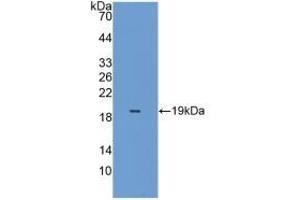 Detection of Recombinant PRDX5, Mouse using Polyclonal Antibody to Peroxiredoxin 5 (PRDX5) (Peroxiredoxin 5 抗体  (AA 49-210))