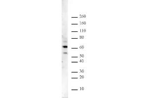 Ikaros pAb tested by Western blot. (IKZF1 抗体  (N-Term))