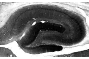 Adult rat hippocampus immunohistochemistry. (DLG3 抗体  (AA 1-120))