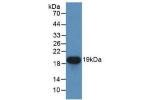Detection of Recombinant CDNF, Human using Monoclonal Antibody to Cerebral Dopamine Neurotrophic Factor (CDNF) (CDNF 抗体  (AA 33-187))