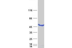 Western Blotting (WB) image for Melanoma Antigen Family A, 4 (MAGEA4) (Transcript Variant 4) protein (Myc-DYKDDDDK Tag) (ABIN2725178)