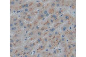 Used in DAB staining on fromalin fixed paraffin- embedded liver tissue (HMGCL 抗体  (AA 1-325))