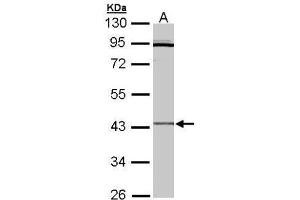 WB Image Sample (30 ug of whole cell lysate) A: Hep G2 , 10% SDS PAGE antibody diluted at 1:3000 (CRLF1 抗体)