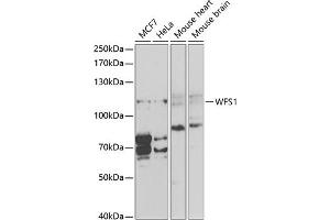 Western blot analysis of extracts of various cell lines, using WFS1 antibody (ABIN3022419, ABIN3022420, ABIN1513689, ABIN1514834 and ABIN6218806) at 1:1000 dilution. (WFS1 抗体  (AA 1-285))