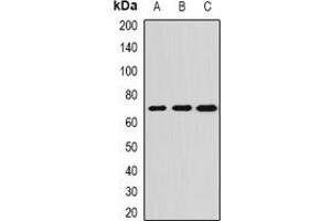 Western blot analysis of ALPPL2 expression in SKOV3 (A), HepG2 (B), mouse testis (C) whole cell lysates. (ALPPL2 抗体)