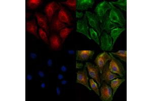 ABIN7094891 and ABIN7098944 staining  cells by IF/ICC. (PAG1 抗体  (Internal Region))
