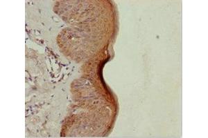 anti-Leucine Rich Repeat and Sterile alpha Motif Containing 1 (LRSAM1) (AA 1-290) antibody