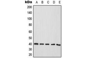 Western blot analysis of CD298 expression in HeLa (A), Jurkat (B), A431 (C), Raw264. (ATP1B3 抗体  (Center))