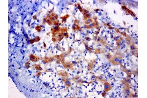 Paraformaldehyde-fixed, paraffin embedded rat liver cancer, Antigen retrieval by boiling in sodium citrate buffer (pH6. (C5orf51 抗体)