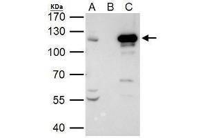 IP Image STAT2 antibody immunoprecipitates STAT2 protein in IP experiments.